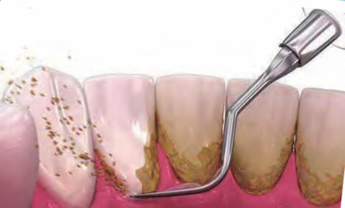 图片13.png 图片13.png