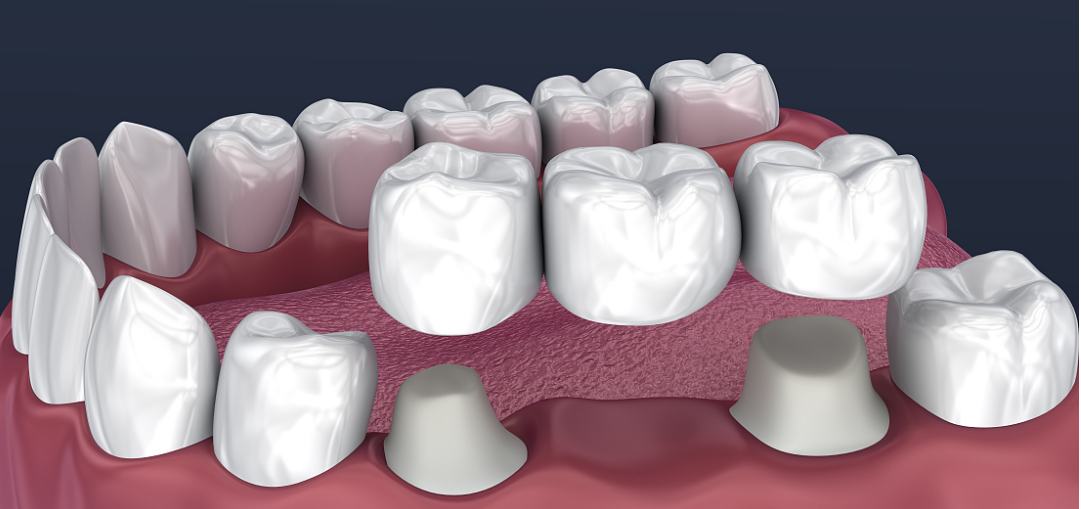 图片5.png 图片5.png