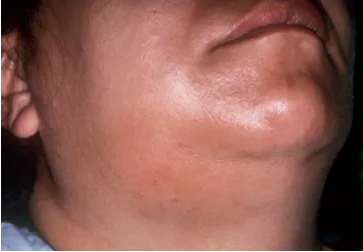 fbda0909-19dd-4f2a-9946-6fa4da8f08a2.png
