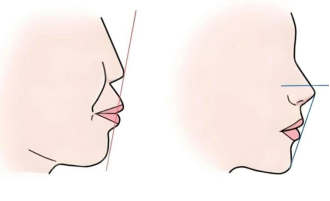 image.png image.png